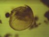 Chydorus sphaericus 3.jpg Chydorus sphaericus 3.jpg