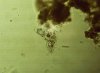 Amoebe 3++.jpg Amoebe 3++.jpg