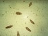 Paramaecium sp.3r.jpg Paramaecium sp.3r.jpg