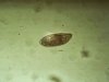 Paramaecium sp.4r.jpg Paramaecium sp.4r.jpg