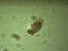 Paramaecium sp.5r.jpg Paramaecium sp.5r.jpg
