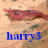 harry3